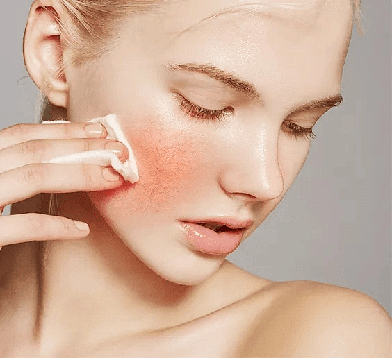 科学护肤正确认识敏感肌