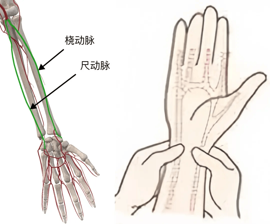 骨间总动脉图片