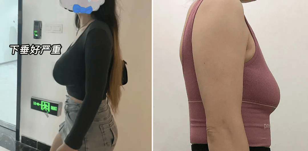 好可悲.女生运动时最伤"胸部"的行为,被国内女生们彻底忽略了