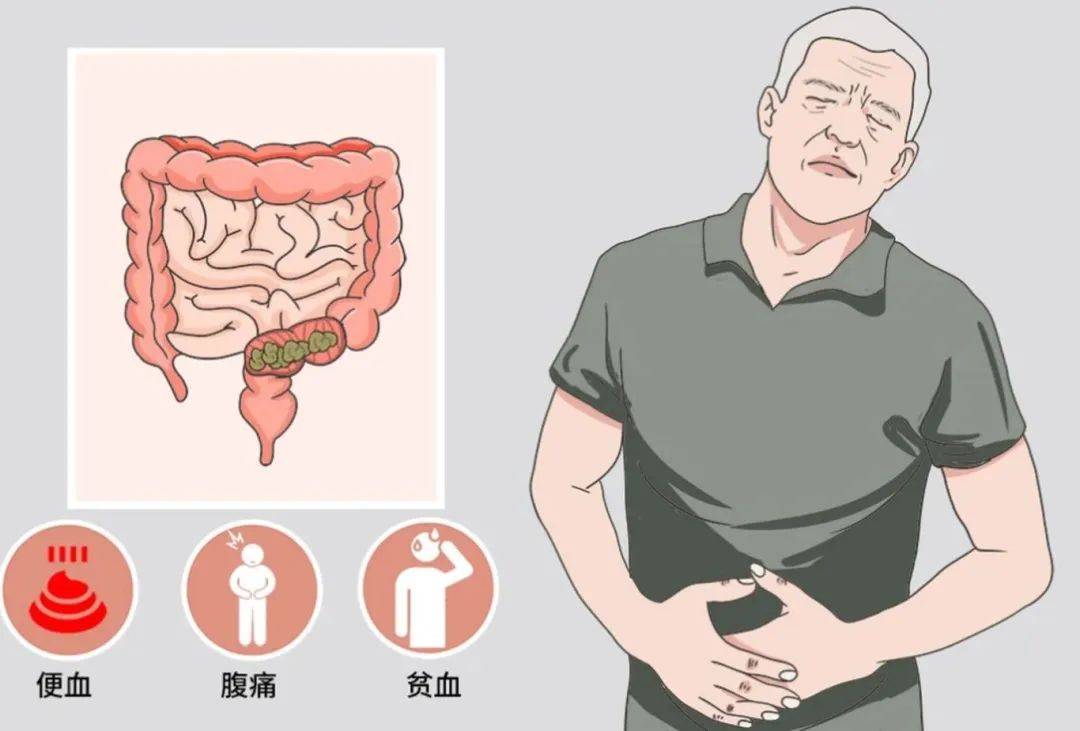 大肠部位疼图片