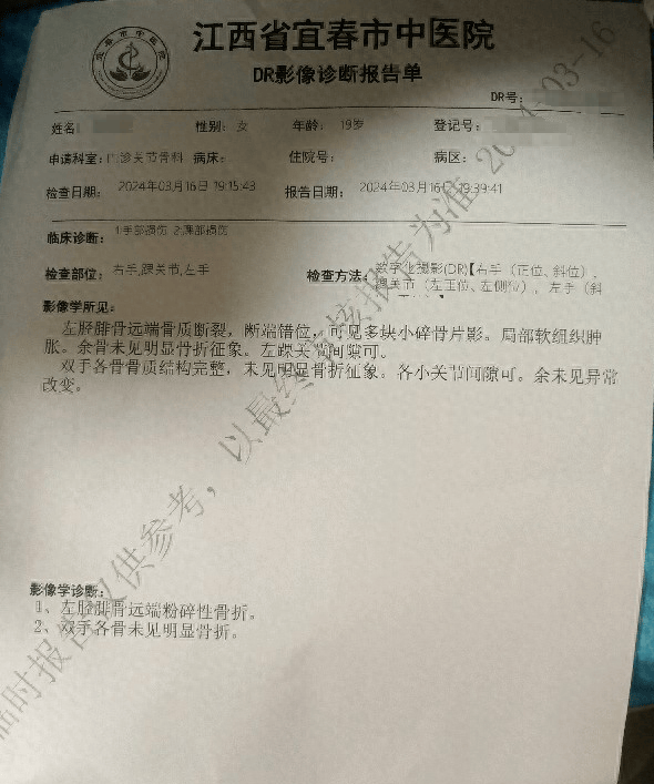 小腿骨折报告单照片图片