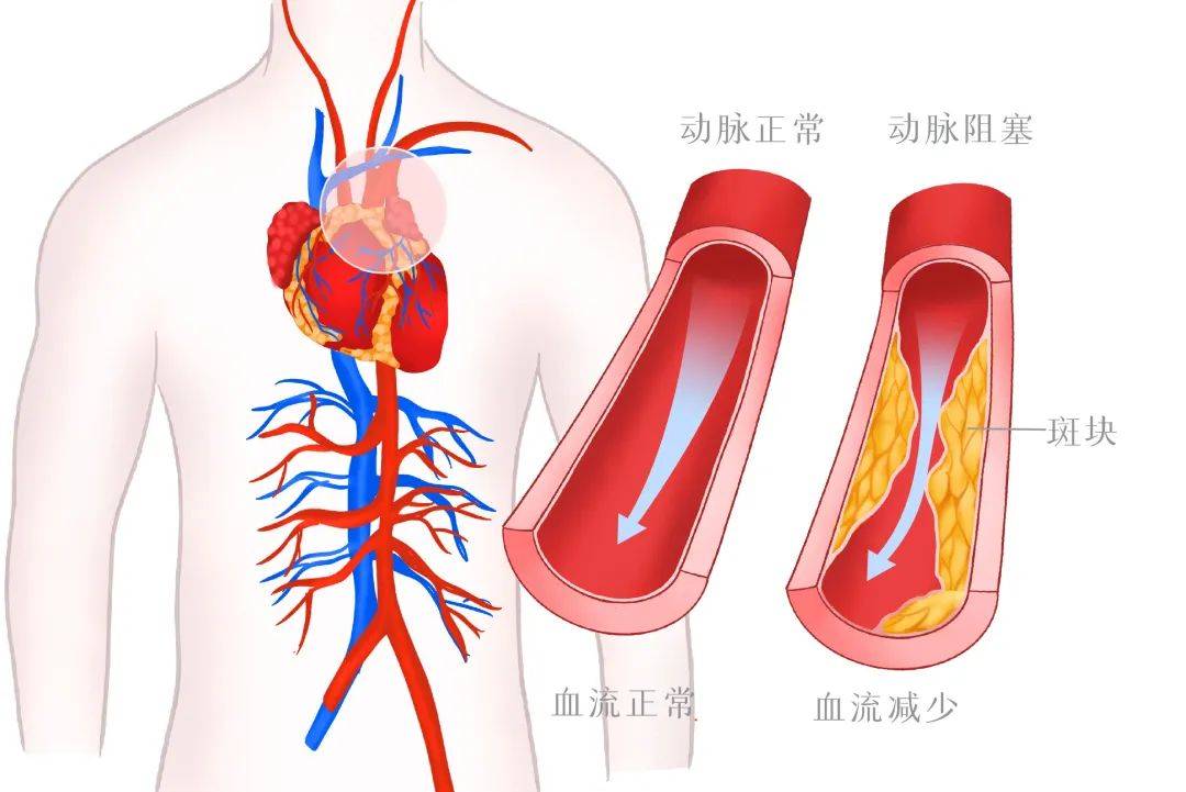 nc患者是什么病图片