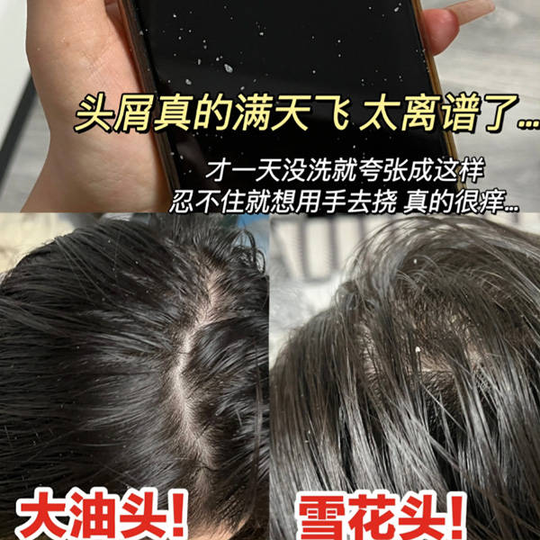 去屑止痒洗发水的有效成分是什么?去屑洗发水排行