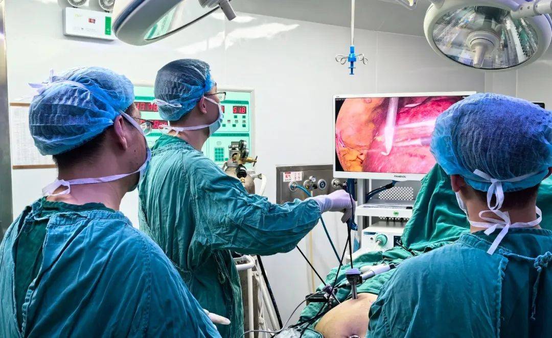 大手术,微创伤!医院完成首例全腹腔镜下肝癌切除术