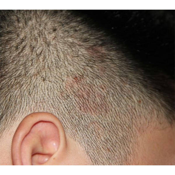 有没有洗发水可以有效地清除头皮屑和油脂?好用的去屑洗发水介绍