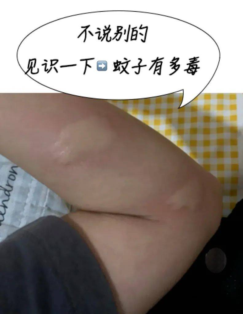【伟才保健】"蚊子肆虐,登革热防控攻略来袭!&quot