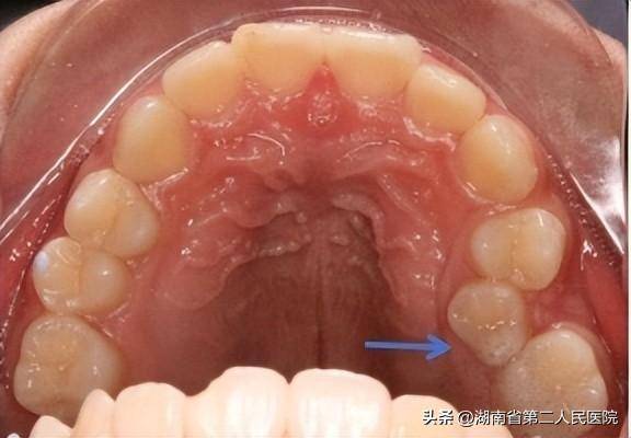 美丽微笑,从"齿"绽放!"世界正畸健康日"福利来啦