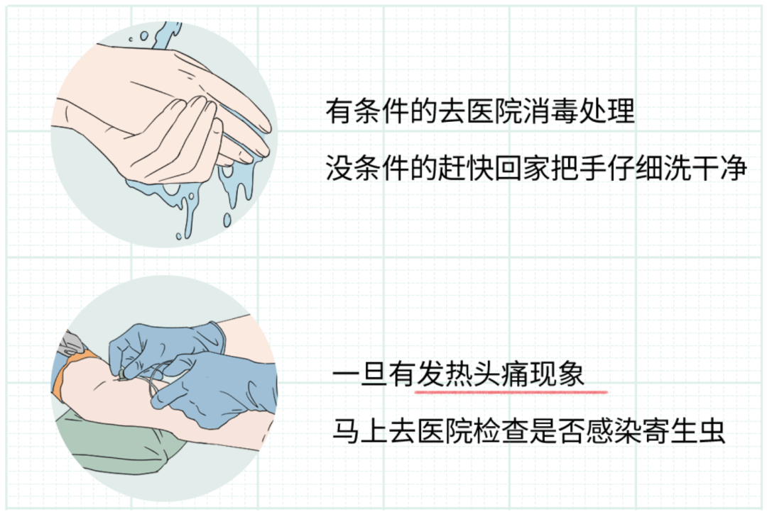 千万别碰,别吃!有人摸了后持续高烧……_蜗牛_寄生虫_南京