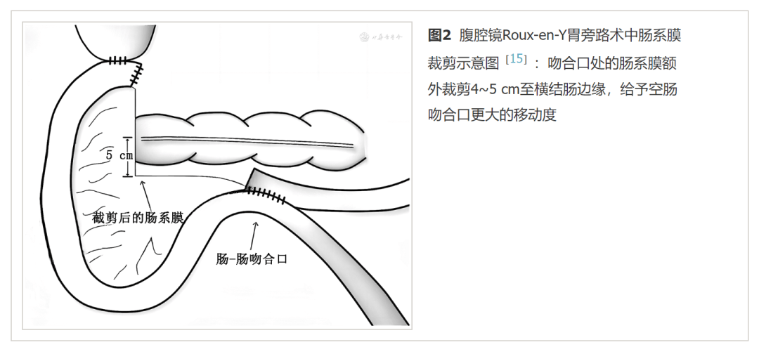 roux-en-y胃旁路术后空肠吻合口扭结的发生机制与临床处理