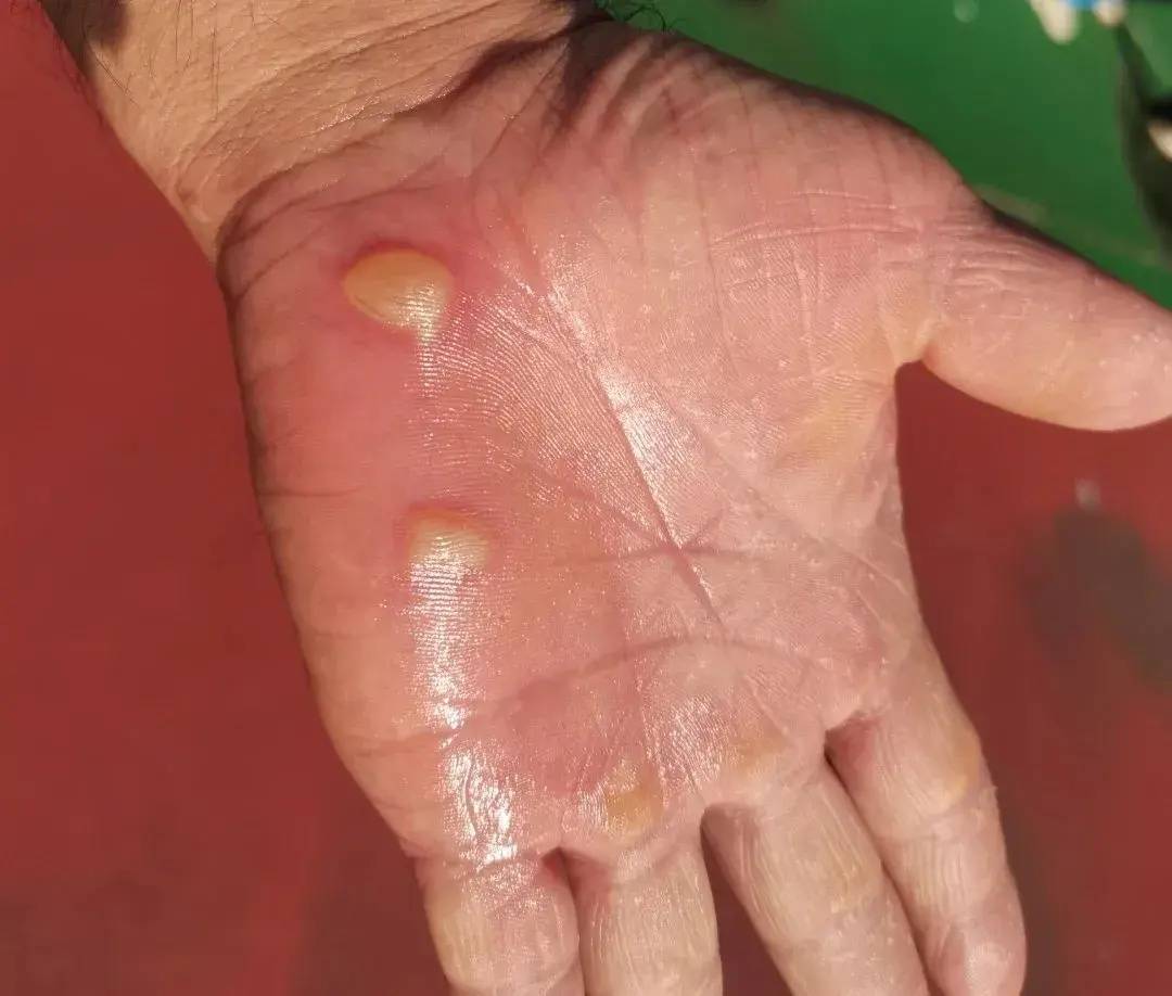 突发火情!路上电动车突然自燃起火,三亚一小学教师变身"灭火英雄"