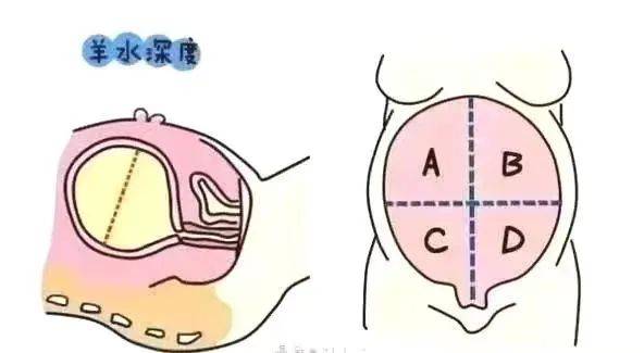 又说我"羊水少"?