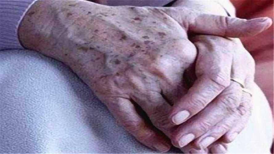 不论年纪,手部2种表现,要重视,可能是癌症前兆,别觉得是过敏