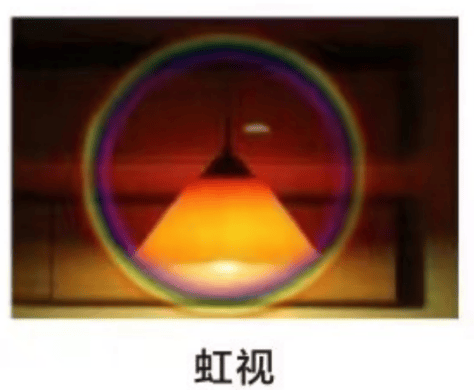 恶心呕吐及视力骤降,虹视.