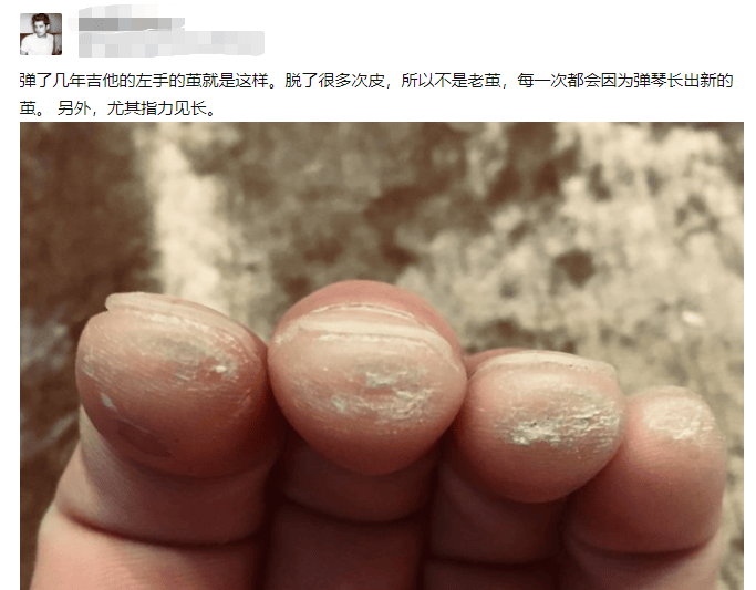 学乐器人的手,惨不忍睹到什么地步?
