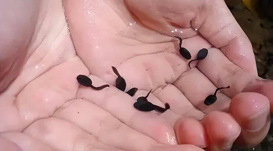 广东女孩暴瘦20斤,脑中取出27厘米活虫,警惕这些食物可别生吃了