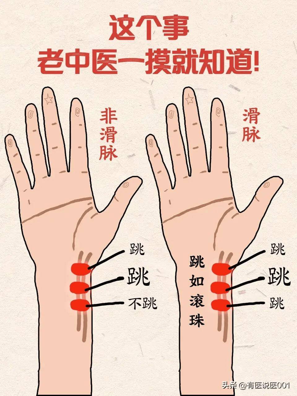 把脉的正确手法图片