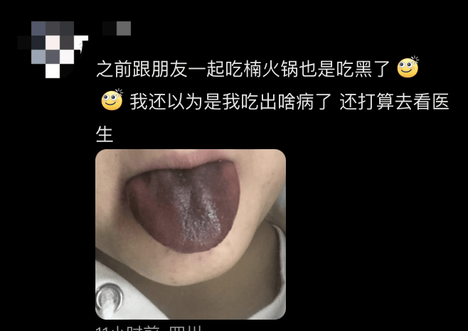 舌头起黑色血泡图片图片