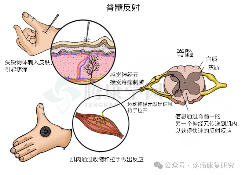 牵张反射特点图片