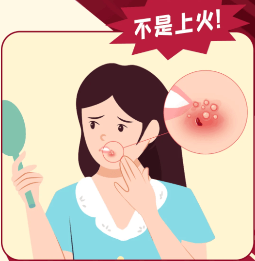 警惕!口唇长这种泡可不是上火哦,小心这种传染性很强的病毒!
