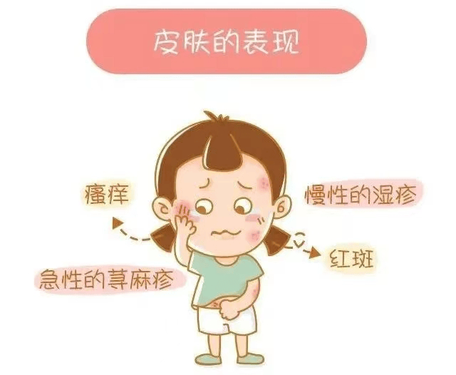 皮肤过敏常见的症状为瘙痒,包括红斑,风团,丘疹,丘疱疹,水疱,渗出
