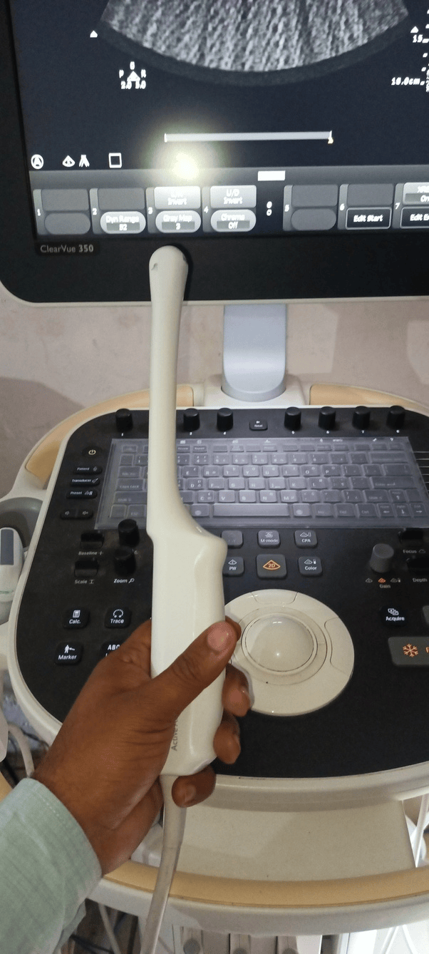 为什么女生做阴超检查时探头要戴避孕套