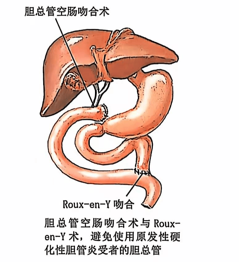 合体实验解剖图图片