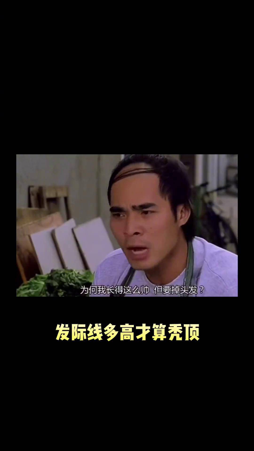 奇葩的秃头参考标准:发际线后退多少厘米才算秃?冷知识 科普 搞笑