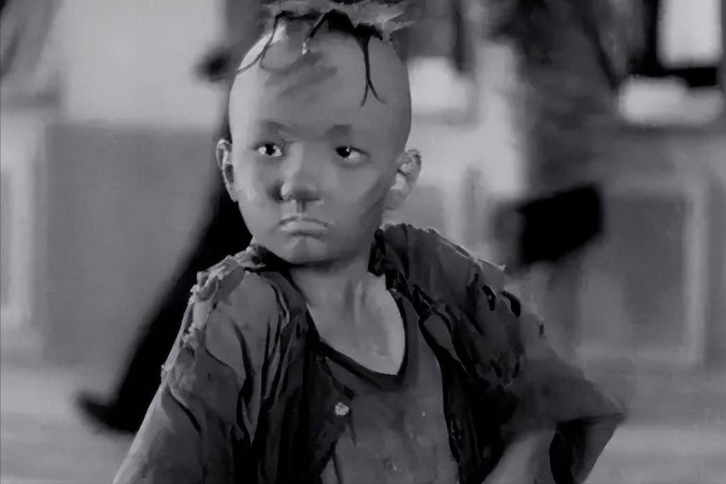 饰演三毛一夜爆火却在14岁秃顶植发挨了300针现在咋样了