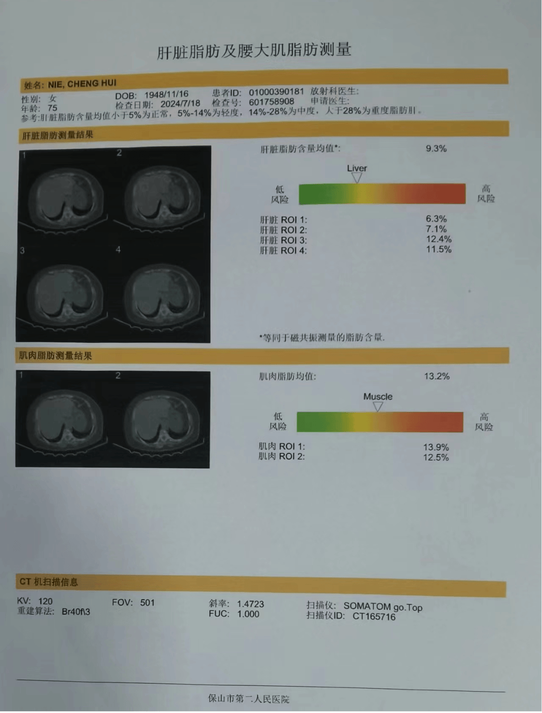 新项目丨一次扫描,4个结果