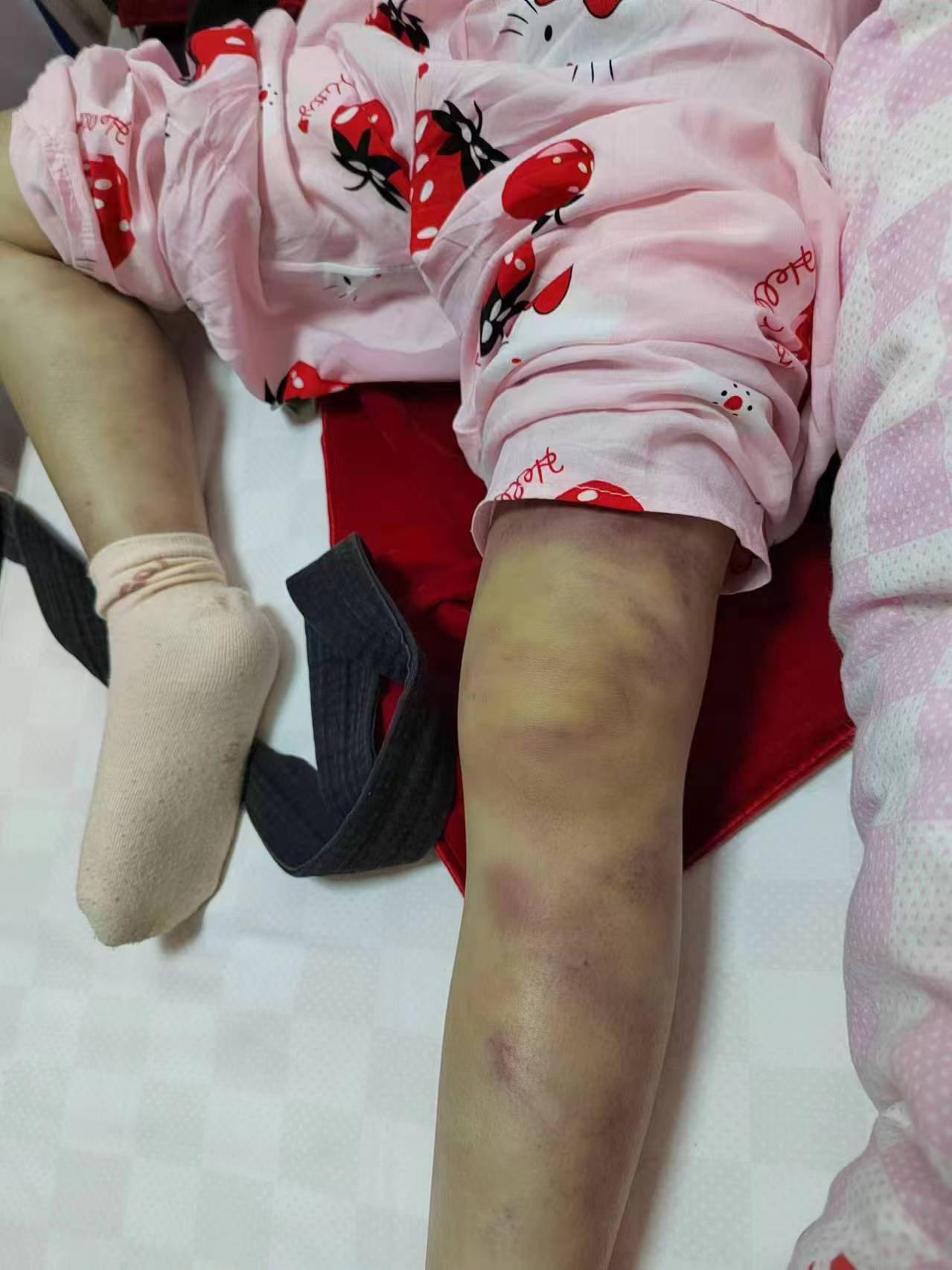 重庆6岁女童疑遭生父女友虐打致死,其生母曾遭家暴诉讼离婚
