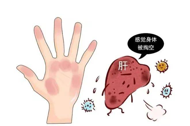 世界肝炎日|关注你的"小心肝"
