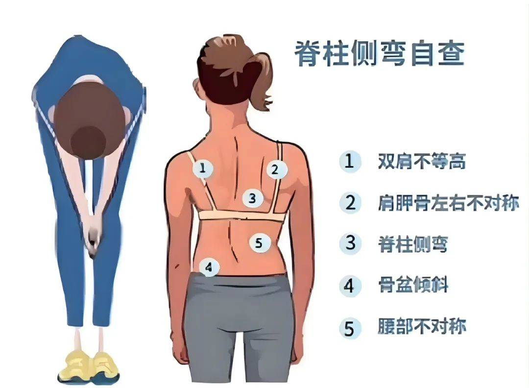 【正骨暖心】关爱脊柱健康,争做正直少年——泉州市正骨医院正脊