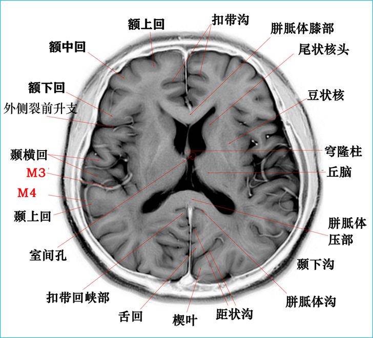 额窦横断面图片