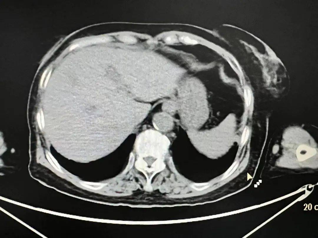 探秘放射 解码健康