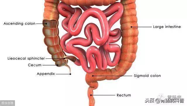 乙状结肠图片图片