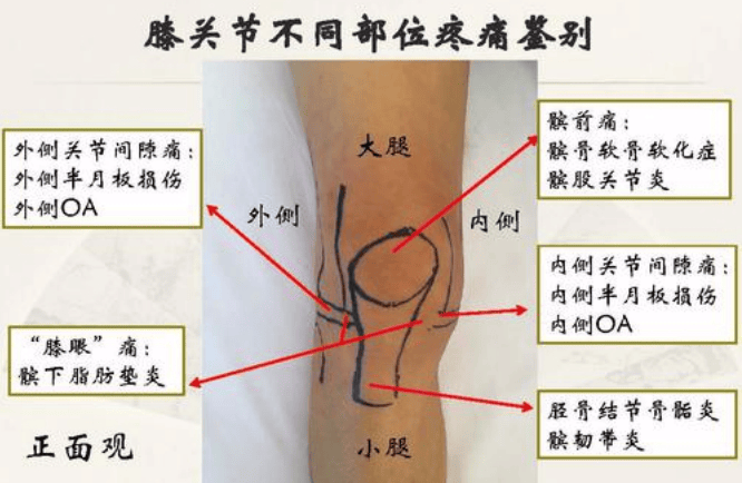 人体腿部关节图图片