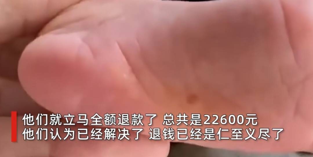 上海一宝妈怒了！月嫂用指甲抠破12天大的婴儿脚底