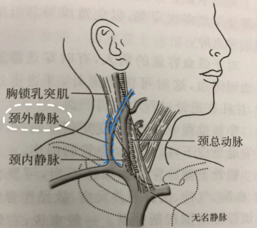 颈动脉管外口的位置图片