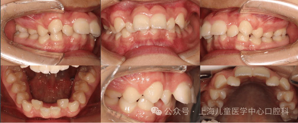 儿医小课堂 273