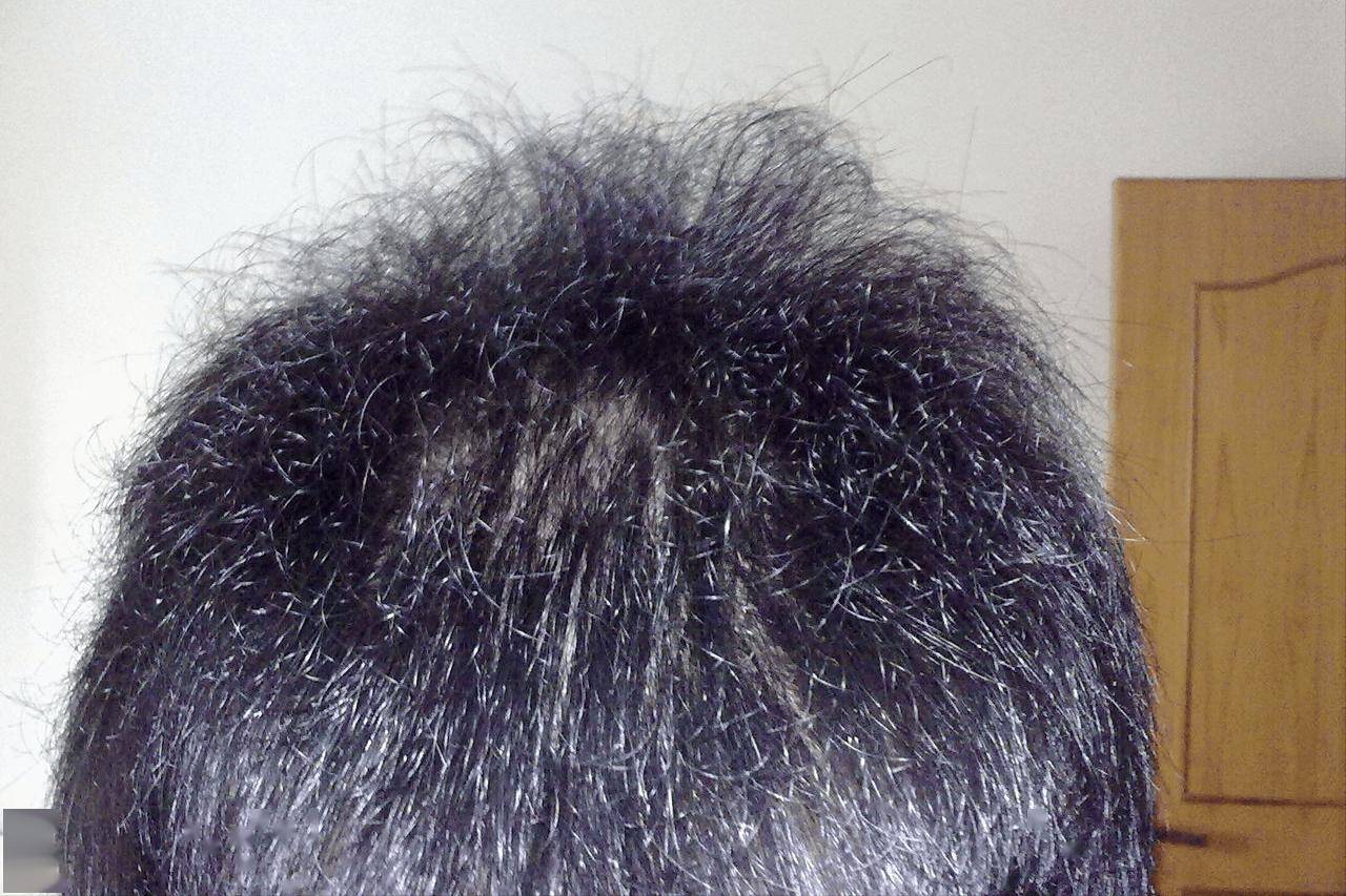 白菜是富锌蔬菜?医生建议:免疫力差的人,多吃这3种蔬菜补锌