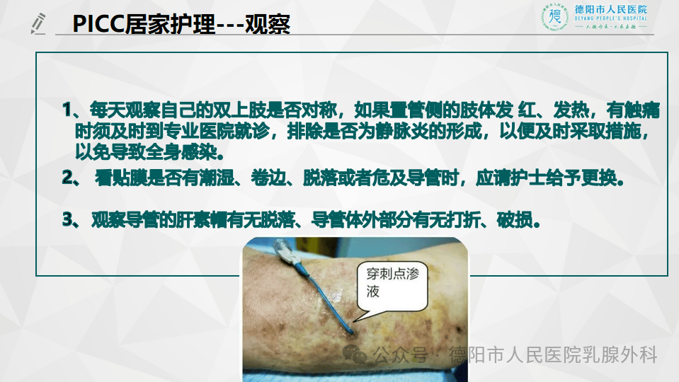 【ppt】picc导管居家护理