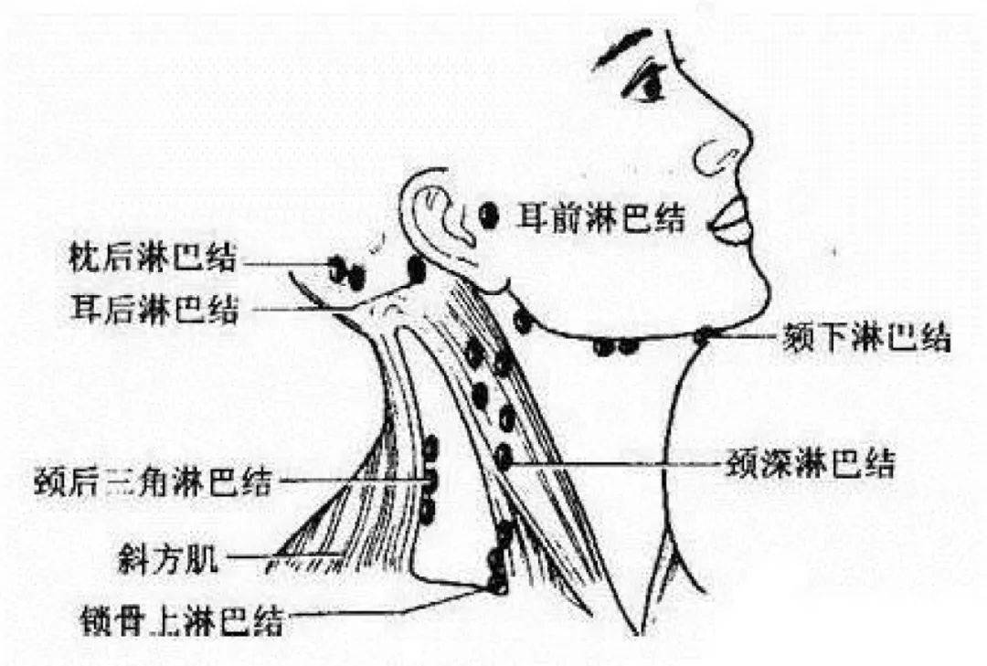 人体3处淋巴决定生死