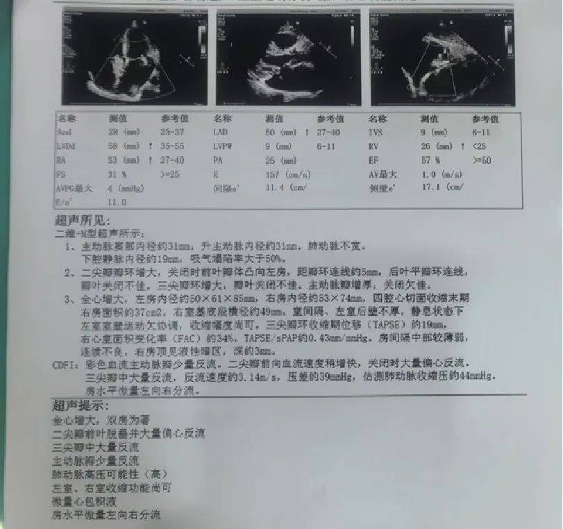 心脏病诊断书病例图片