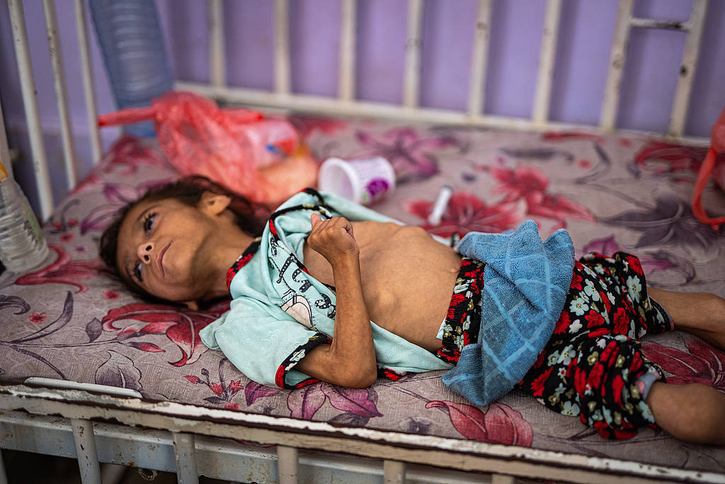 巴以冲突不断,加沙正在经历粮食危机,营养不良的病例,特别是儿童