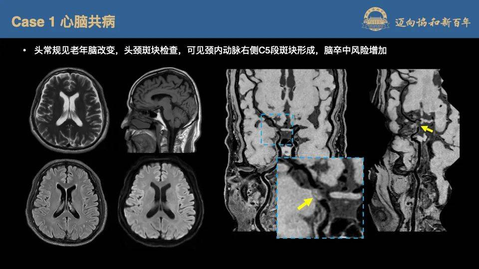 专业方向是心血管影像学和分子影像学国家杰出青年科学基金获得者