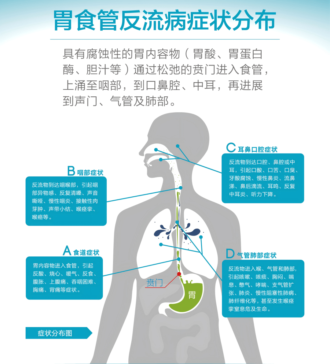 【技术突破】聊城市第二人民医院胃肠外科:破解胃食管反流谜团,为患者