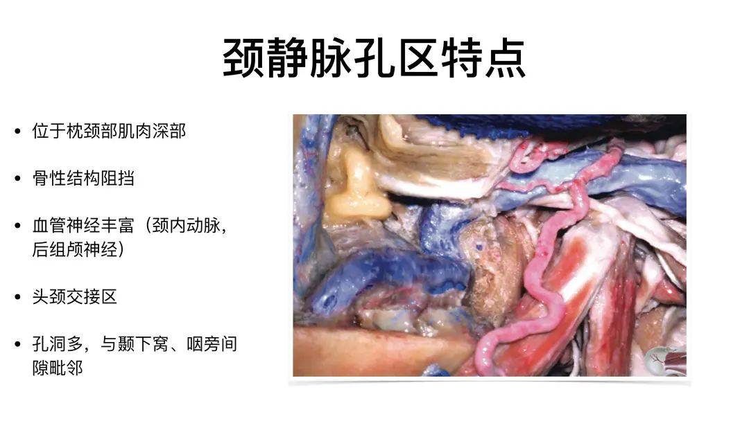 颈静脉孔区解剖彩图图片