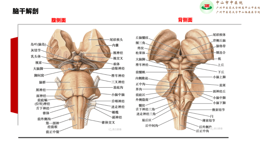 脑干腹侧面图片