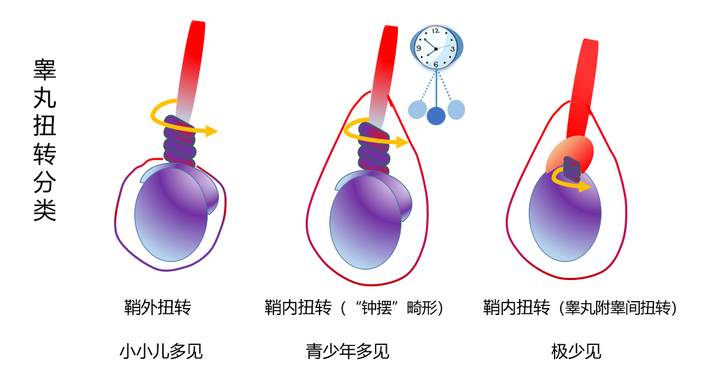 新生儿阴囊发黑的图片图片