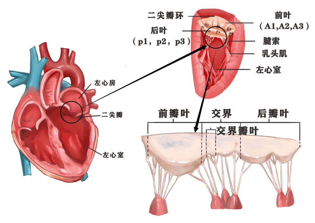 二尖瓣叶分区图图片